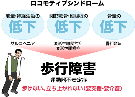 器 不 安定 症 運動 運動器不安定症について：PT